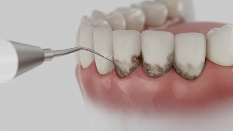 Reliable Dental Implants contractor in Baxter, TN by Smile Center Dentistry